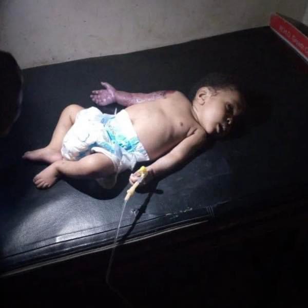 [Nigeria] Father allegedly beats his 2-month-old son with hanger for disturbing his sleep - leading to amputation