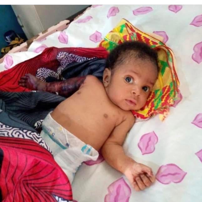 [Nigeria] Father allegedly beats his 2-month-old son with hanger for disturbing his sleep - leading to amputation