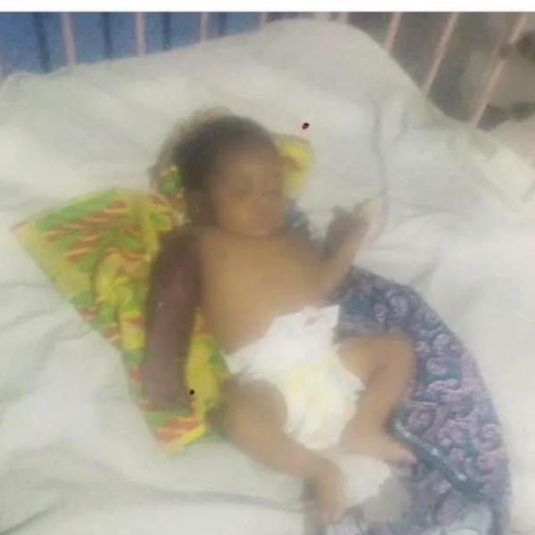 [Nigeria] Father allegedly beats his 2-month-old son with hanger for disturbing his sleep - leading to amputation