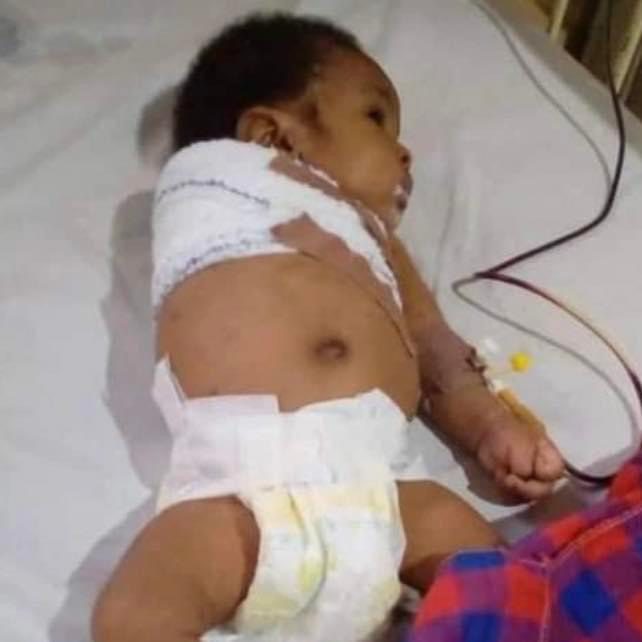 [Nigeria] Father allegedly beats his 2-month-old son with hanger for disturbing his sleep - leading to amputation