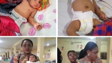 [Nigeria] Father allegedly beats his 2-month-old son with hanger for disturbing his sleep - leading to amputation