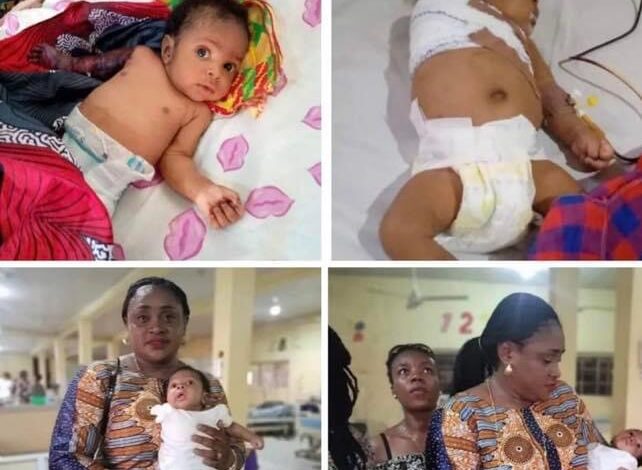 [Nigeria] Father allegedly beats his 2-month-old son with hanger for disturbing his sleep - leading to amputation