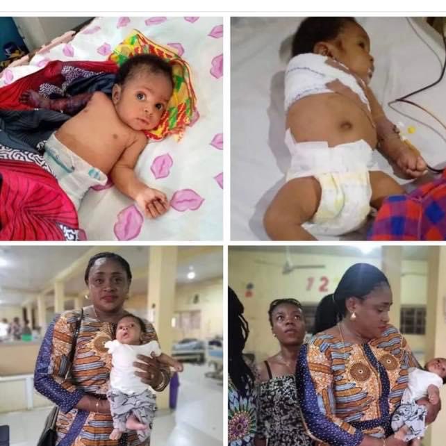 [Nigeria] Father allegedly beats his 2-month-old son with hanger for disturbing his sleep - leading to amputation