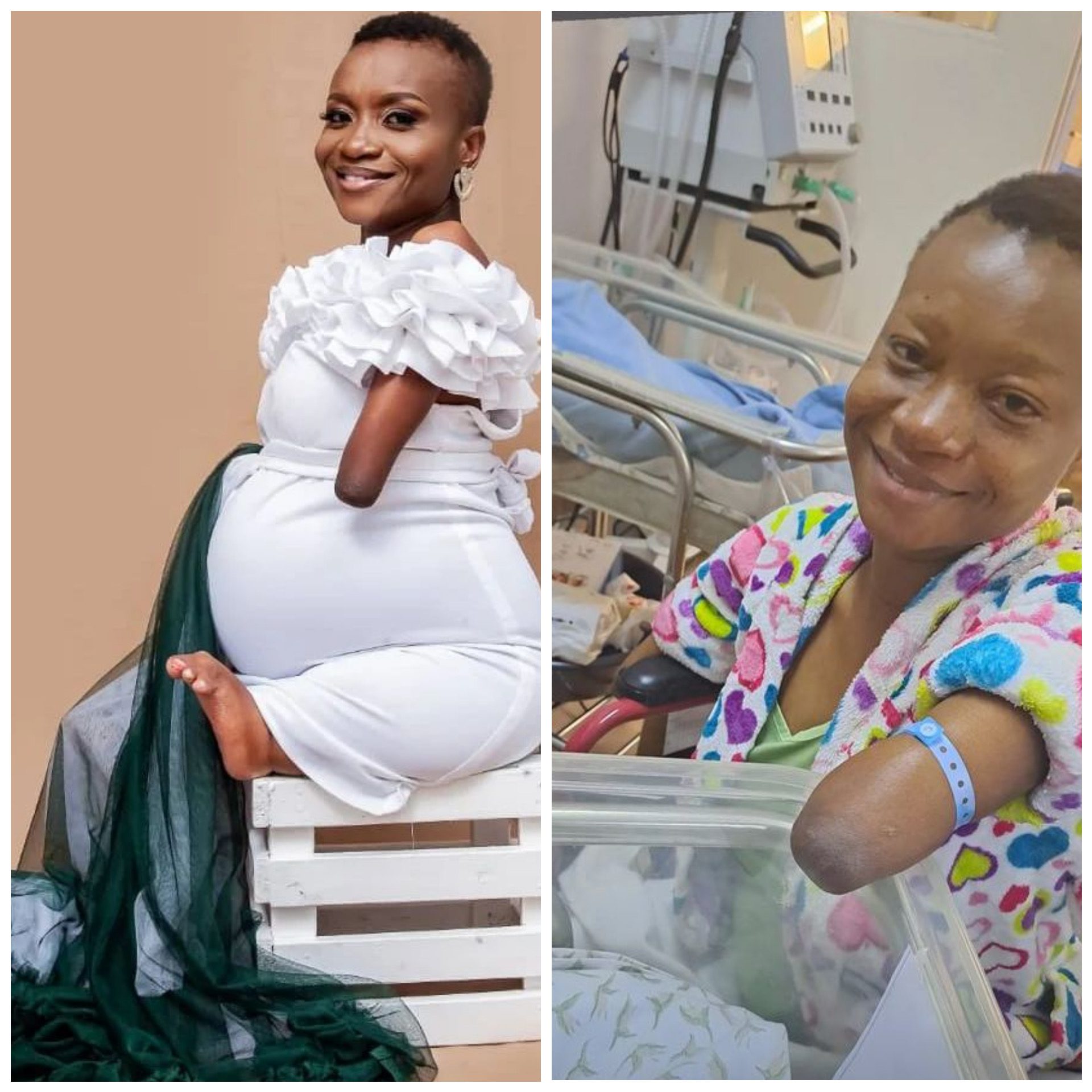 Zimbabwean woman born without limbs gives birth to her first child